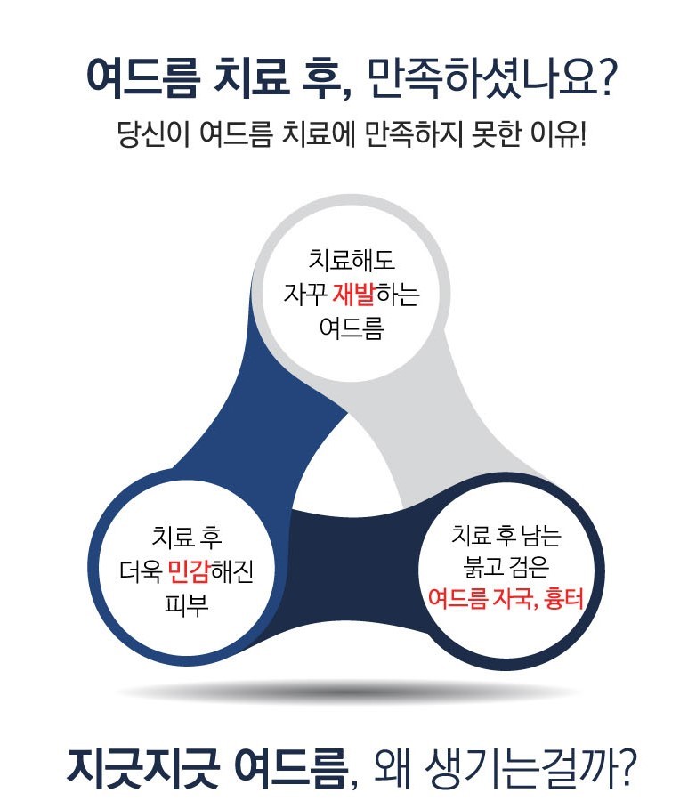 지속되는 여드름, 원인과 치료 방법 관련 이미지 2