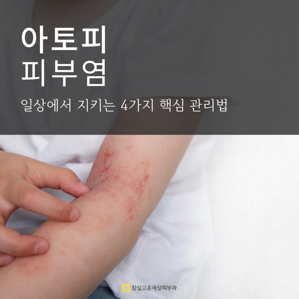 아토피 피부염, 일상에서 지키는 4가지 핵심 관리법 관련 이미지 1