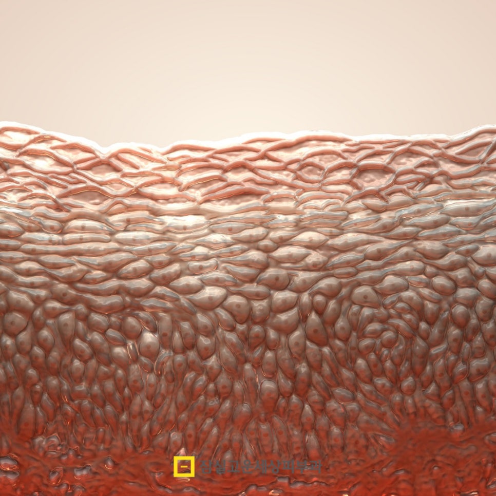 피부질환, 단순 트러블이 아닙니다. 관련 이미지 5