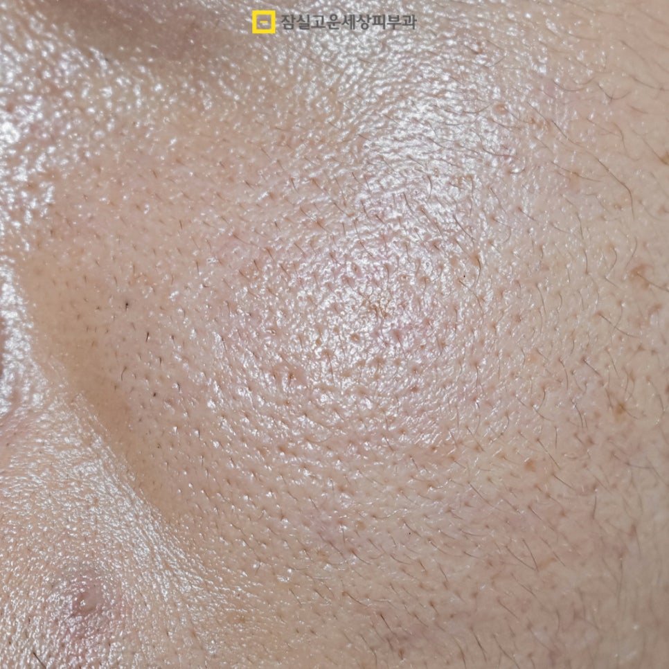 [잠실고운세상피부과] 피부관리 가이드, 기초부터 고급까지! 관련 이미지 3