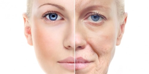 처진피부 리프팅레이저 No.1 써마지CPT (리프팅레이저효과/잠실역피부과/잠실리프팅/잠실고운세상) 관련 이미지 3