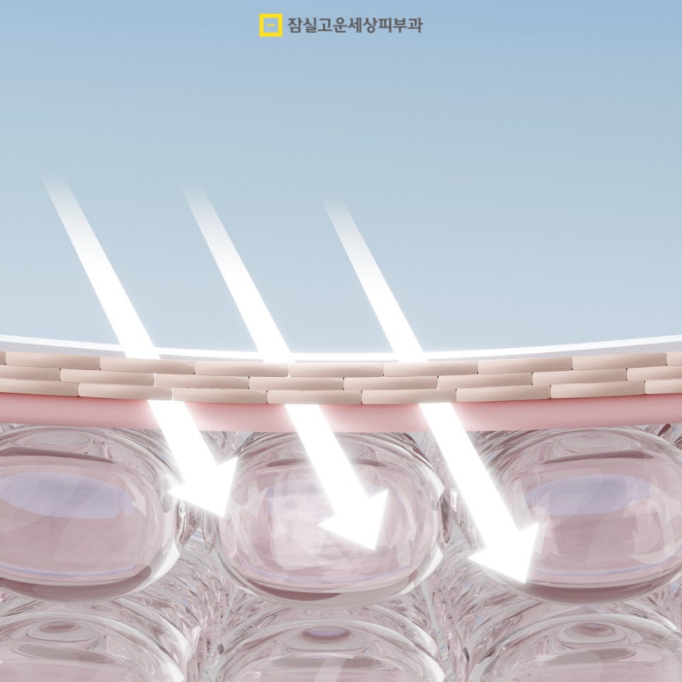 피부관리정보, 무더위에도 빛나는 맑은 피부를 위한 실전 가이드 관련 이미지 2