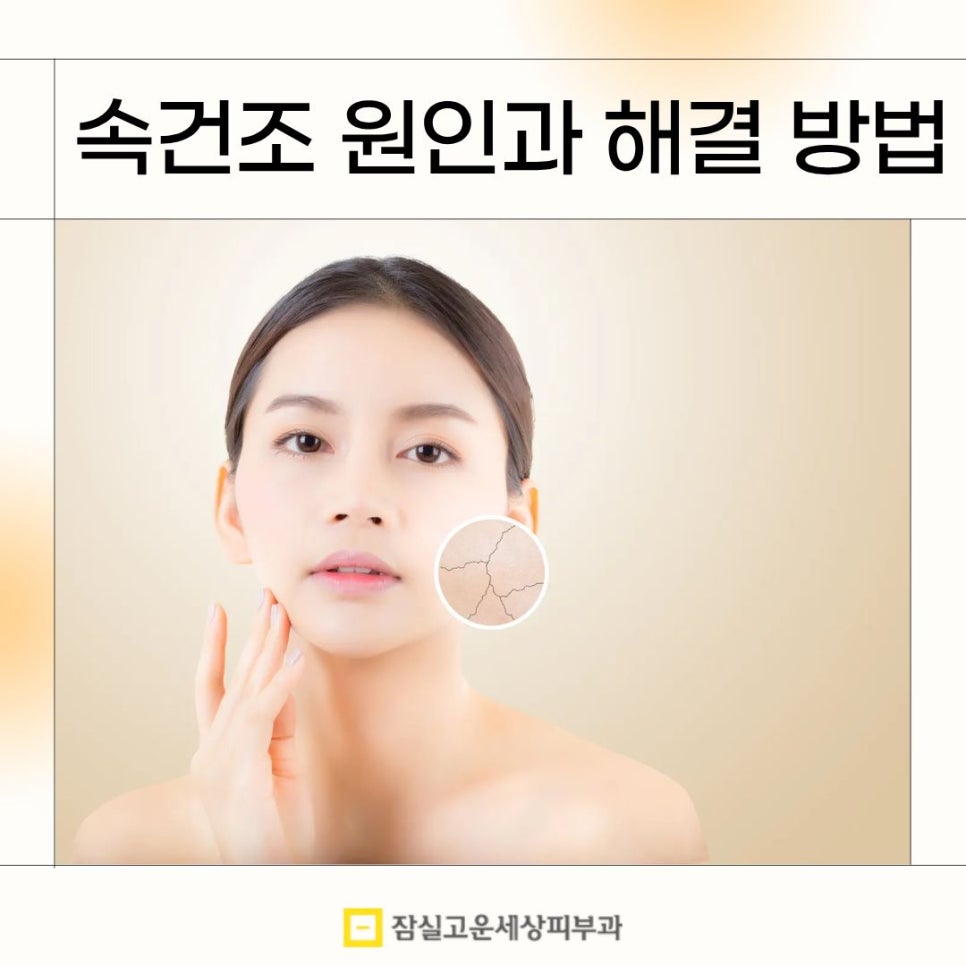 속건조, 수분크림만으론 안되는 피부의 구조적 문제 관련 이미지 1