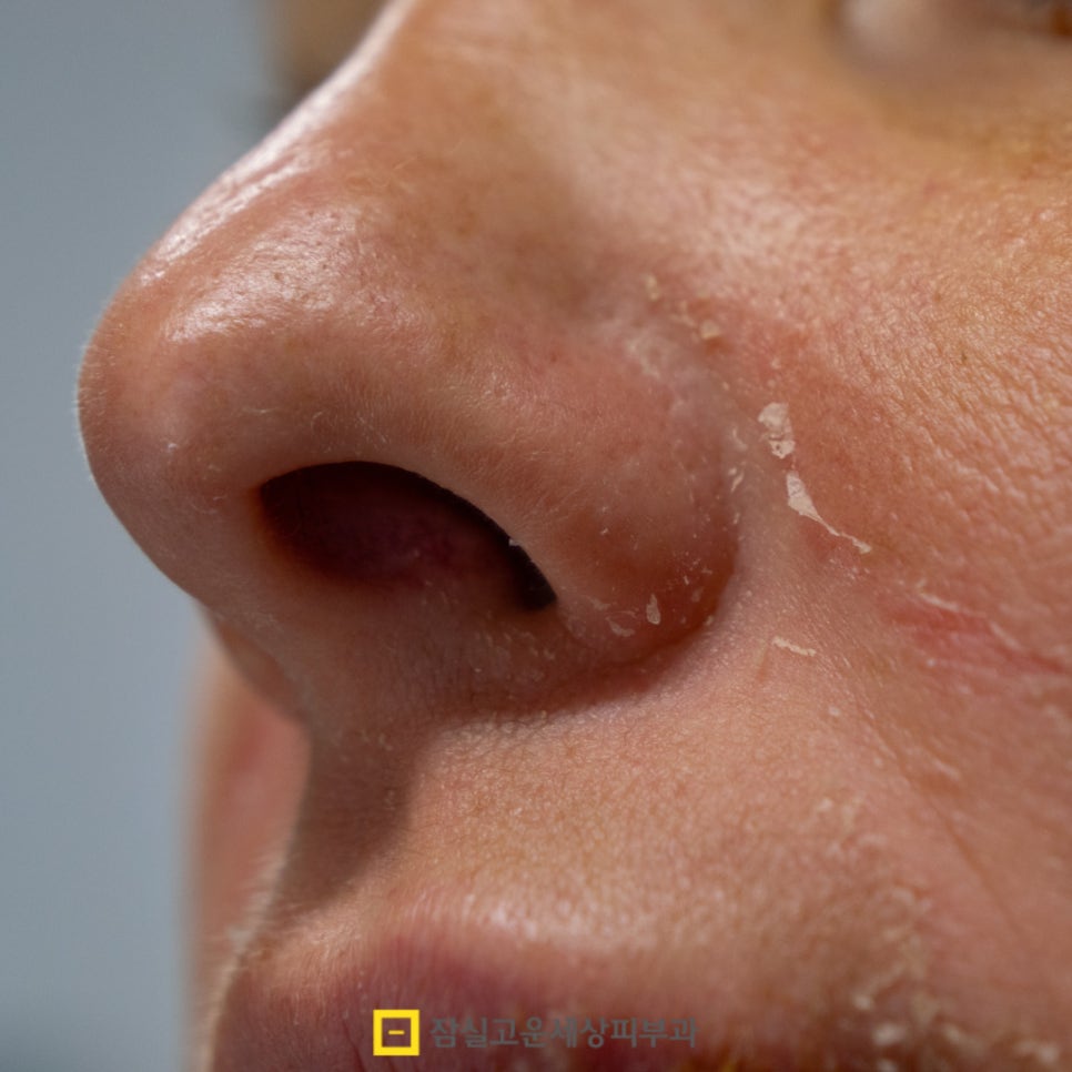 얼굴은 번들거리는데 속은 당기는 이유와 해결 방법 관련 이미지 5