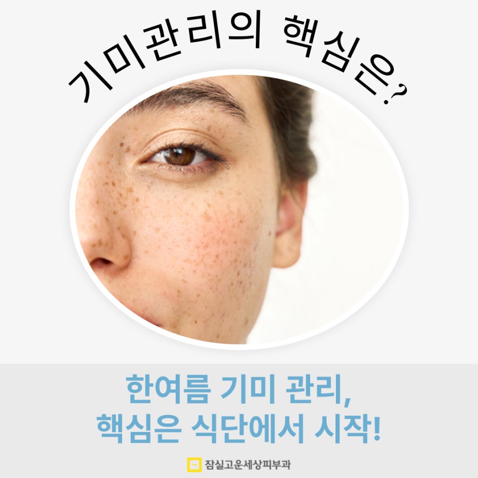 한여름, 기미 관리의 핵심은 관련 이미지 1