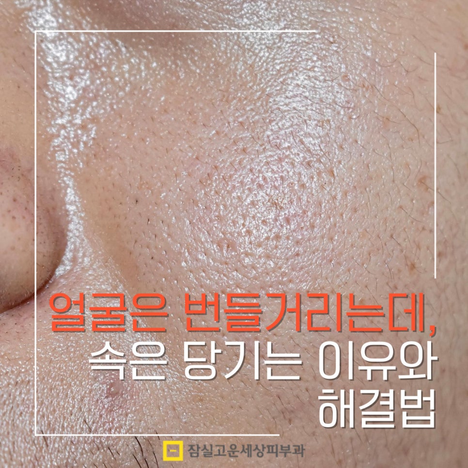 얼굴은 번들거리는데 속은 당기는 이유와 해결 방법 관련 이미지 1
