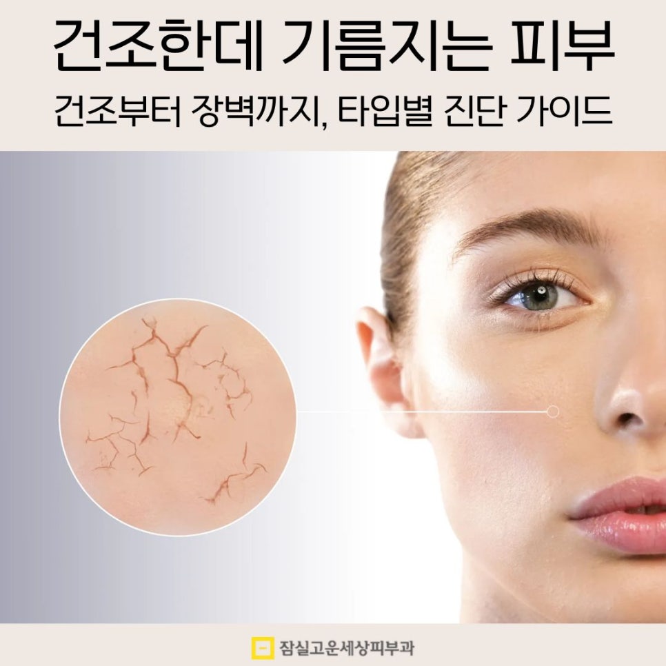 건조한데 기름지는 피부? 손건조부터 장벽까지, 타입별 진단 가이드 관련 이미지 1