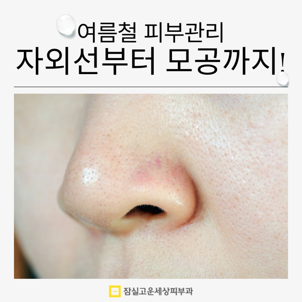 피부관리정보, 올 여름 자외선부터 모공까지 한 번에 잡는 비법 관련 이미지 1