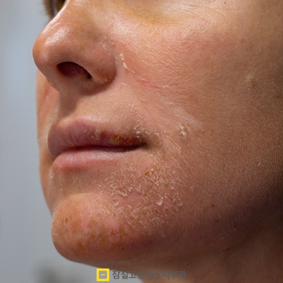 남자 피부관리 기초, 꼭 지켜야 할 다섯 가지 원칙 관련 이미지 6