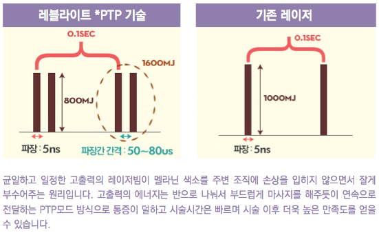 어버이날선물 효도시술 잠실고운세상 레블라이트! 관련 이미지 5