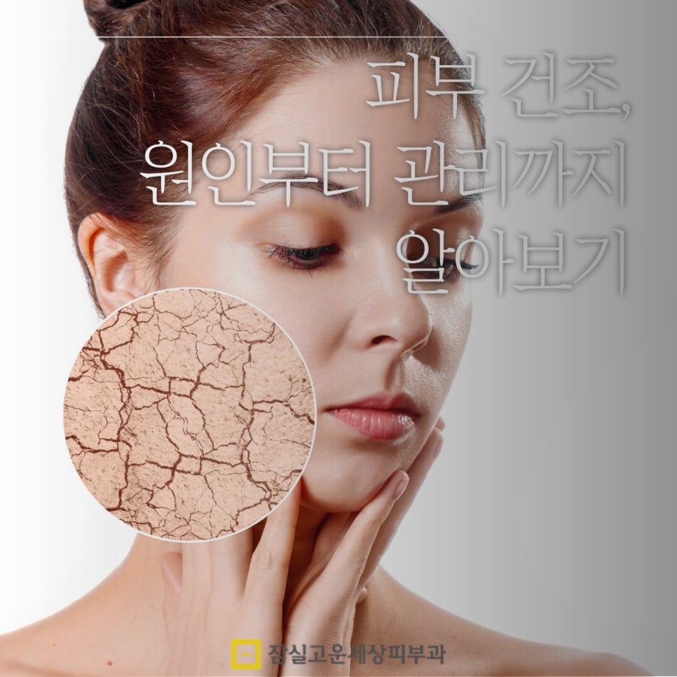 피부 건조, 원인부터 관리까지 알아보기 관련 이미지 1