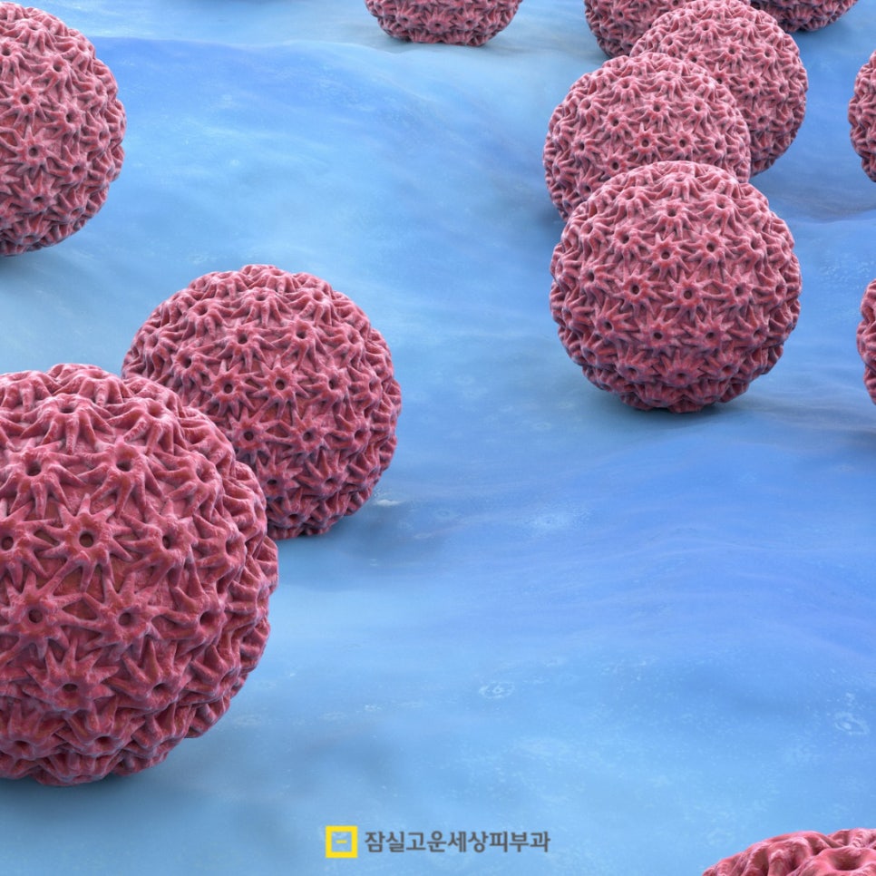 피부에 나타나는 작은 돌기, 편평사마귀에 대해 알아야 할 모든 것 관련 이미지 3