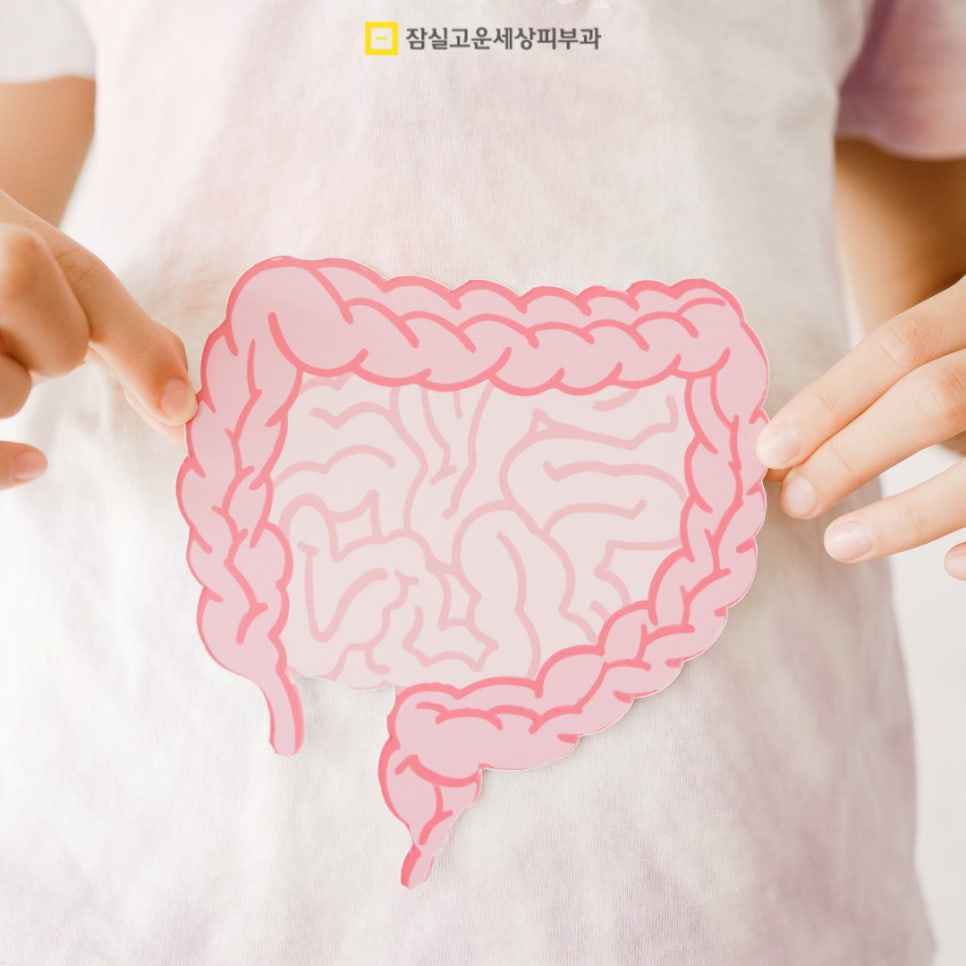 여드름 Q&A, 주요 궁금증들 관련 이미지 4