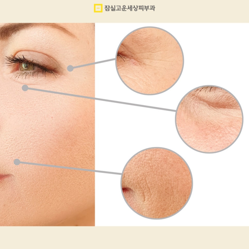 피부 노화의 모든 것, 원인부터 예방 방법까지 관련 이미지 4