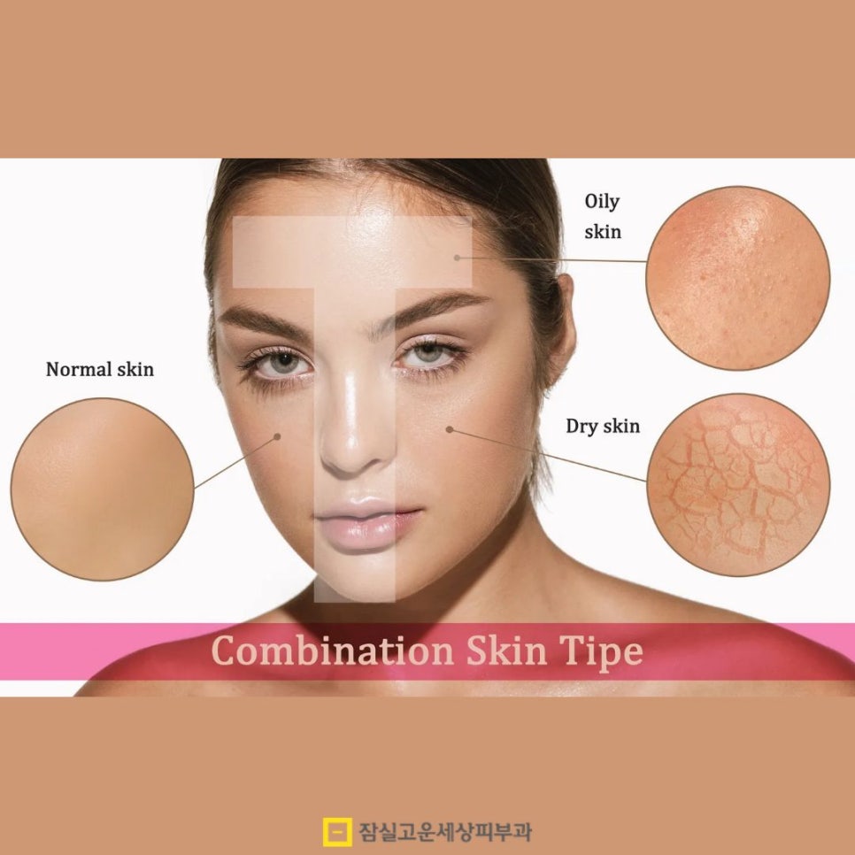 건조한데 기름지는 피부? 손건조부터 장벽까지, 타입별 진단 가이드 관련 이미지 10