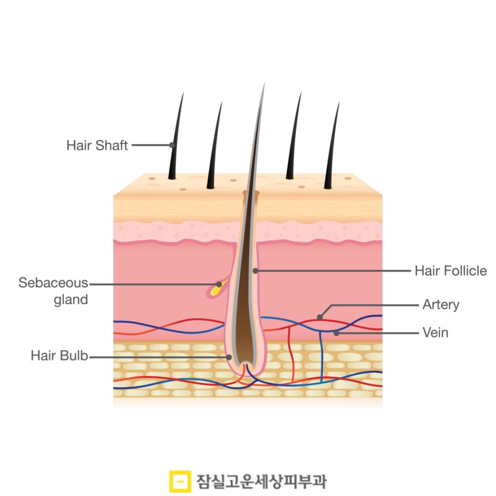 피부과 여드름 치료, 실펌 엑스가 주목받는 이유 관련 이미지 4