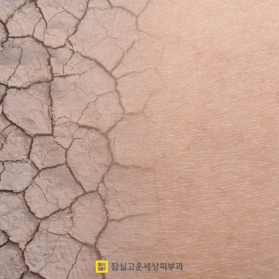 피부가 뒤집힐 땐 이유가 있습니다. 관련 이미지 3