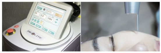 어버이날선물 효도시술 잠실고운세상 레블라이트! 관련 이미지 4