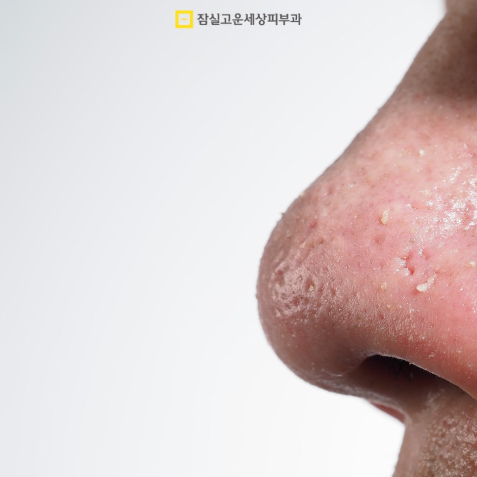 수분부족형 지성, 환절기에 더 건조해지는 이유 관련 이미지 5