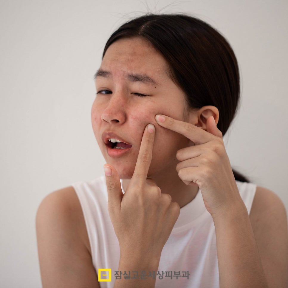 우리 아이 사춘기 여드름, 언제부터 어떻게 관리해야 할까? 관련 이미지 3