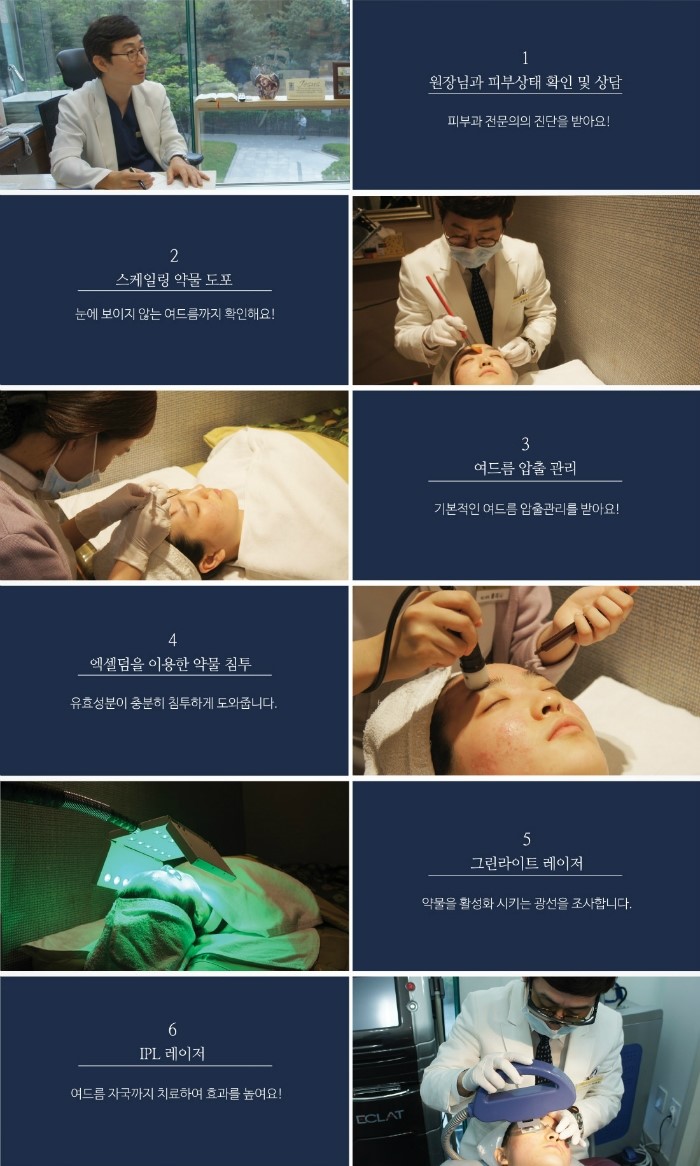 기말고사 스트레스로 인한 여드름, 제대로 잡으려면? 잠실여드름피부과 핌클케어와 함께 하세요!  (잠실여드름/잠실피부과/송파구피부과/여드름치료/여드름케어) 관련 이미지 8