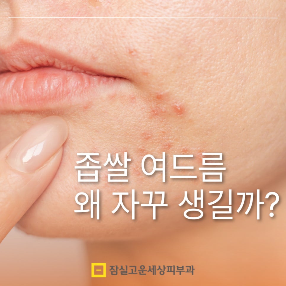 좁쌀 여드름, 왜 자꾸 올라올까요? 관련 이미지 1