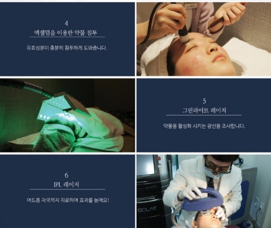 잠실여드름피부과 J핌클케어입니다 (잠실고운세상피부과/잠실역피부과) 관련 이미지 12