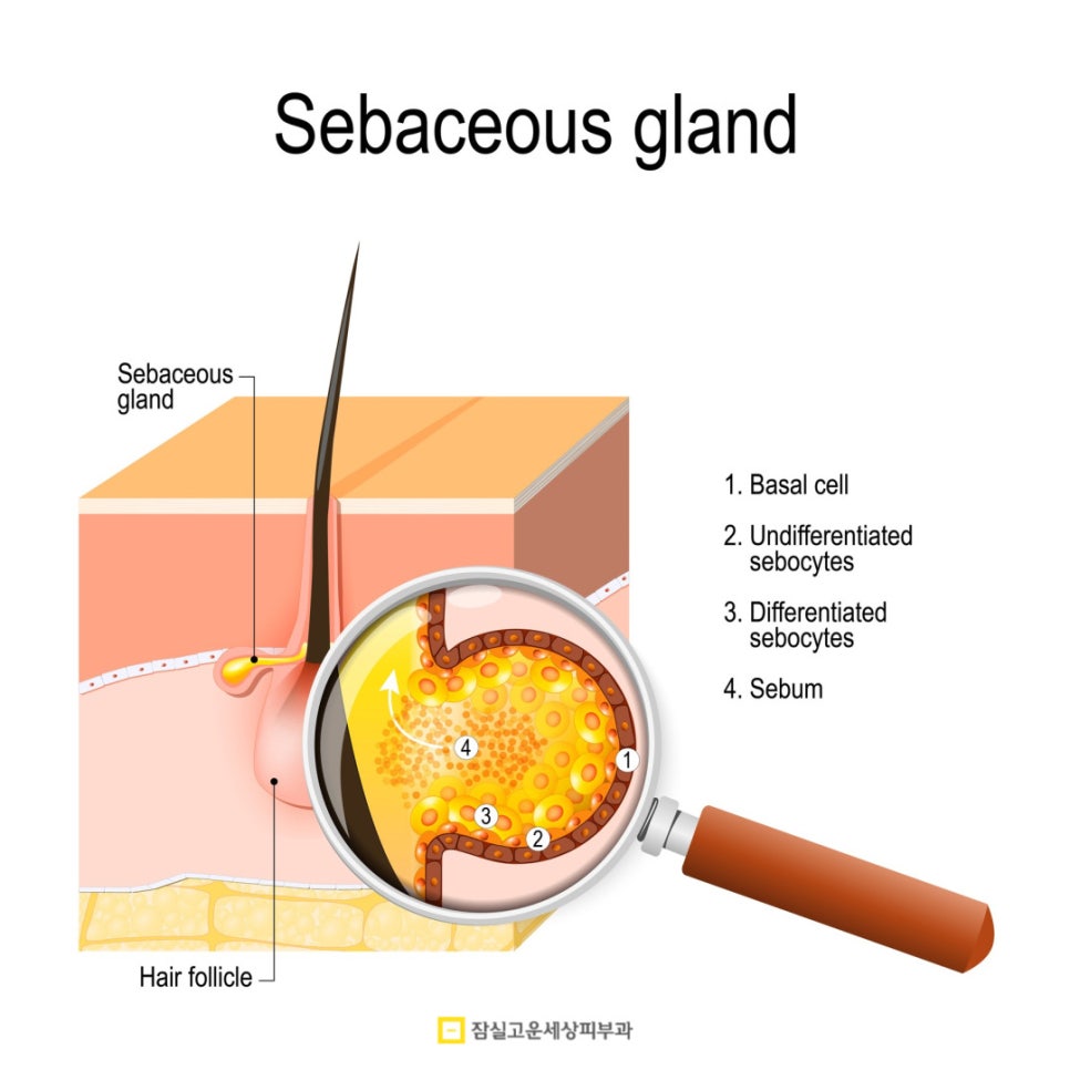 왜 나만 여드름이 사라지지 않을까? 숨은 원인 5가지 관련 이미지 3