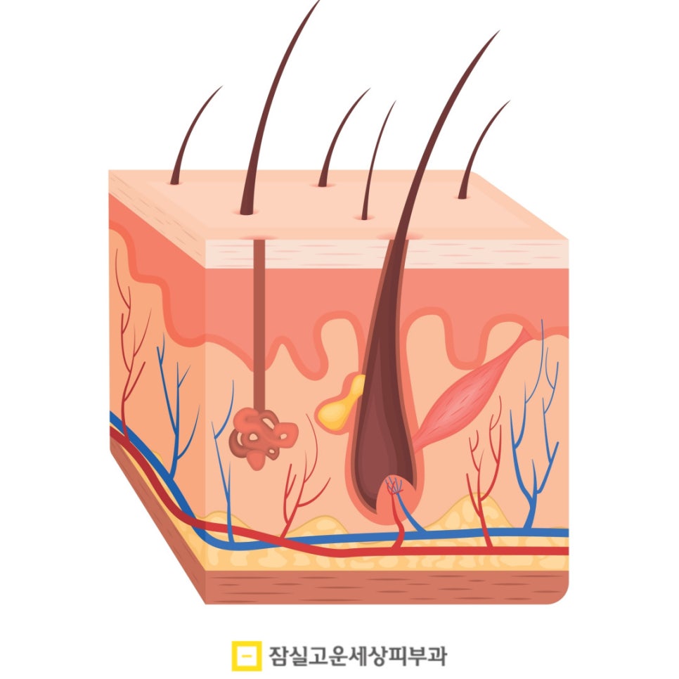 갑자기 트러블이 많아졌다면, 환절기 알러지성 피부일 수도 있어요 관련 이미지 3