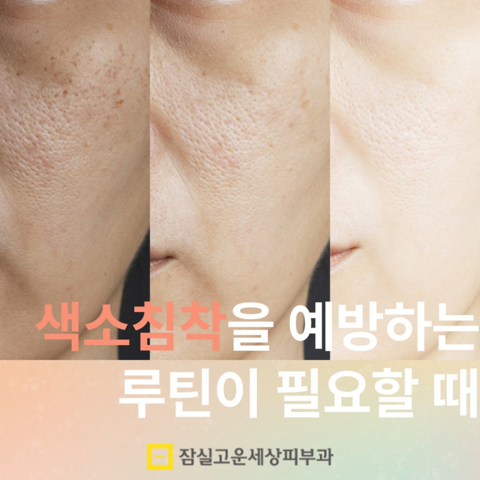 피부에 생기는 기미와 잡티, 지금부터 관리 시작해야 합니다. 관련 이미지 1