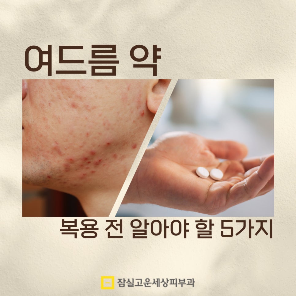 여드름 약, 복용 전 꼭 알아야 할 5가지 핵심 포인트 관련 이미지 1