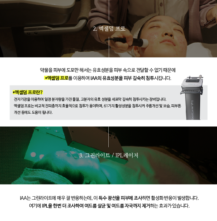 잠실에서만 만나보실 수 있는 특별한 핌클케어 프로그램! (잠실고운세상/여드름치료/핌클케어/잠실여드름피부과) 관련 이미지 8