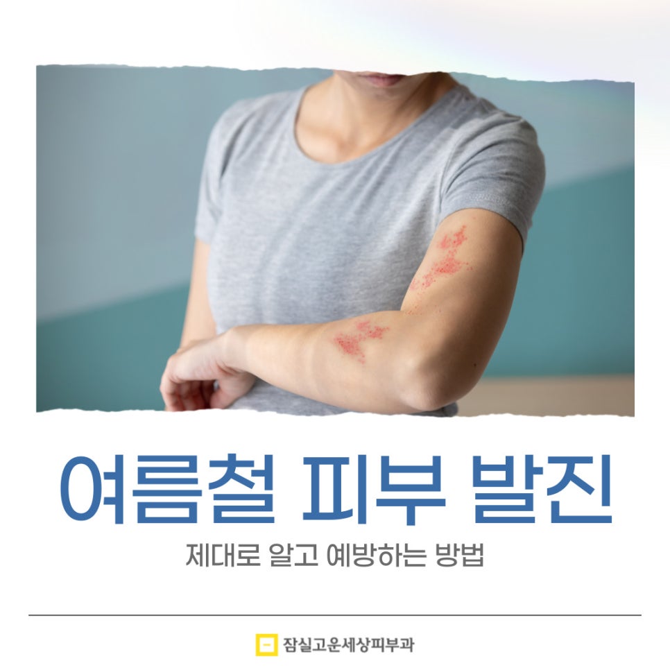 여름철 피부 발진, 제대로 알고 예방하는 방법 관련 이미지 1