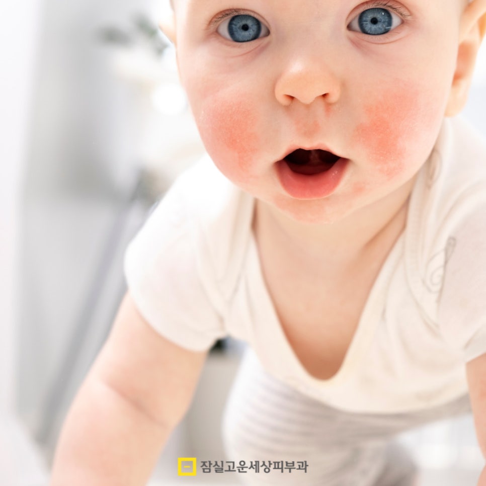 아토피 관리, 습관에서 시작되는 건강한 피부 관련 이미지 3