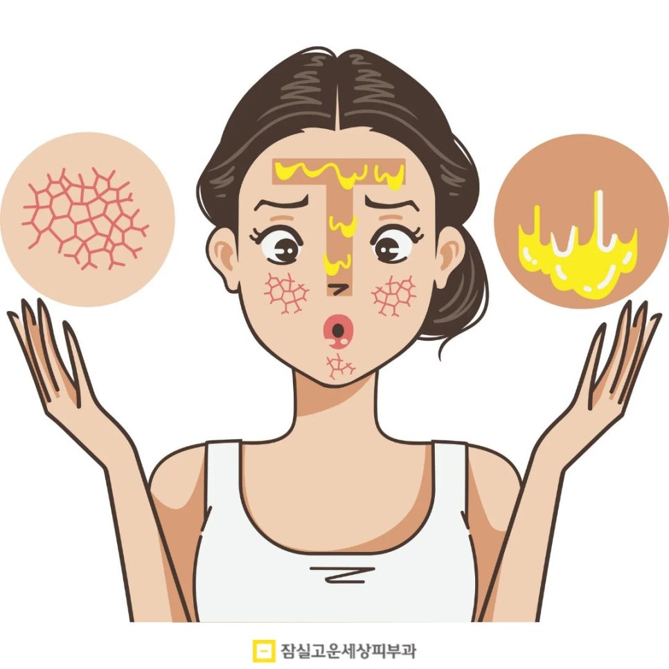 건조한데 기름지는 피부? 손건조부터 장벽까지, 타입별 진단 가이드 관련 이미지 11