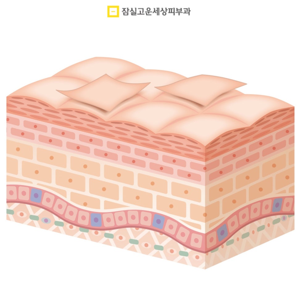 늘어난 모공, 정말 줄일 수 있을까? 관련 이미지 5