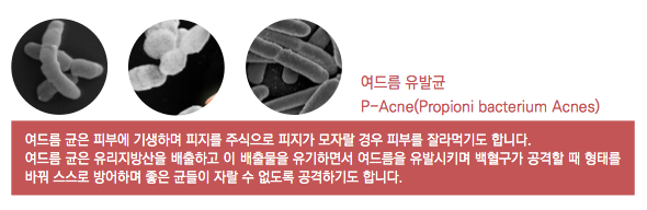 방학맞이 여드름 피부관리, 잠실고운세상피부과의 핌클케어!(여드름치료/잠실역피부과/잠실고운세상피부과) 관련 이미지 6