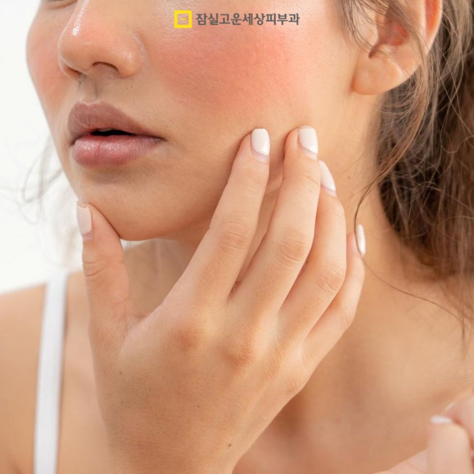 안면홍조, 왜 사라졌다가 다시 심해질까? 관련 이미지 6