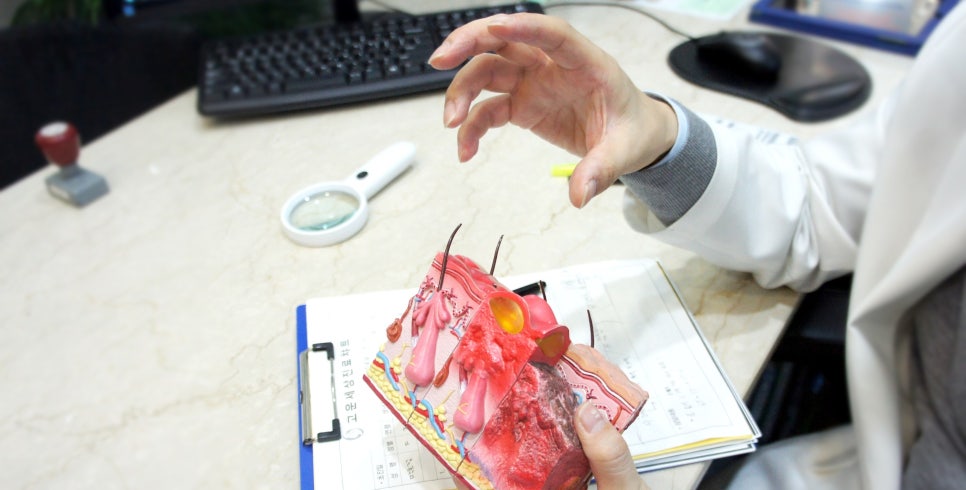 잠실 안면홍조 피부과 브이빔레이저 (잠실고운세상피부과/잠실역피부과추천) 관련 이미지 3