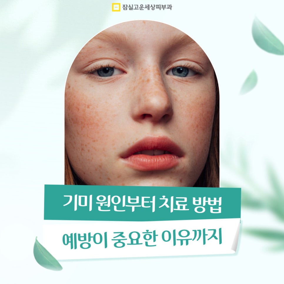 기미 원인부터 치료 방법, 예방이 중요한 이유까지 관련 이미지 1