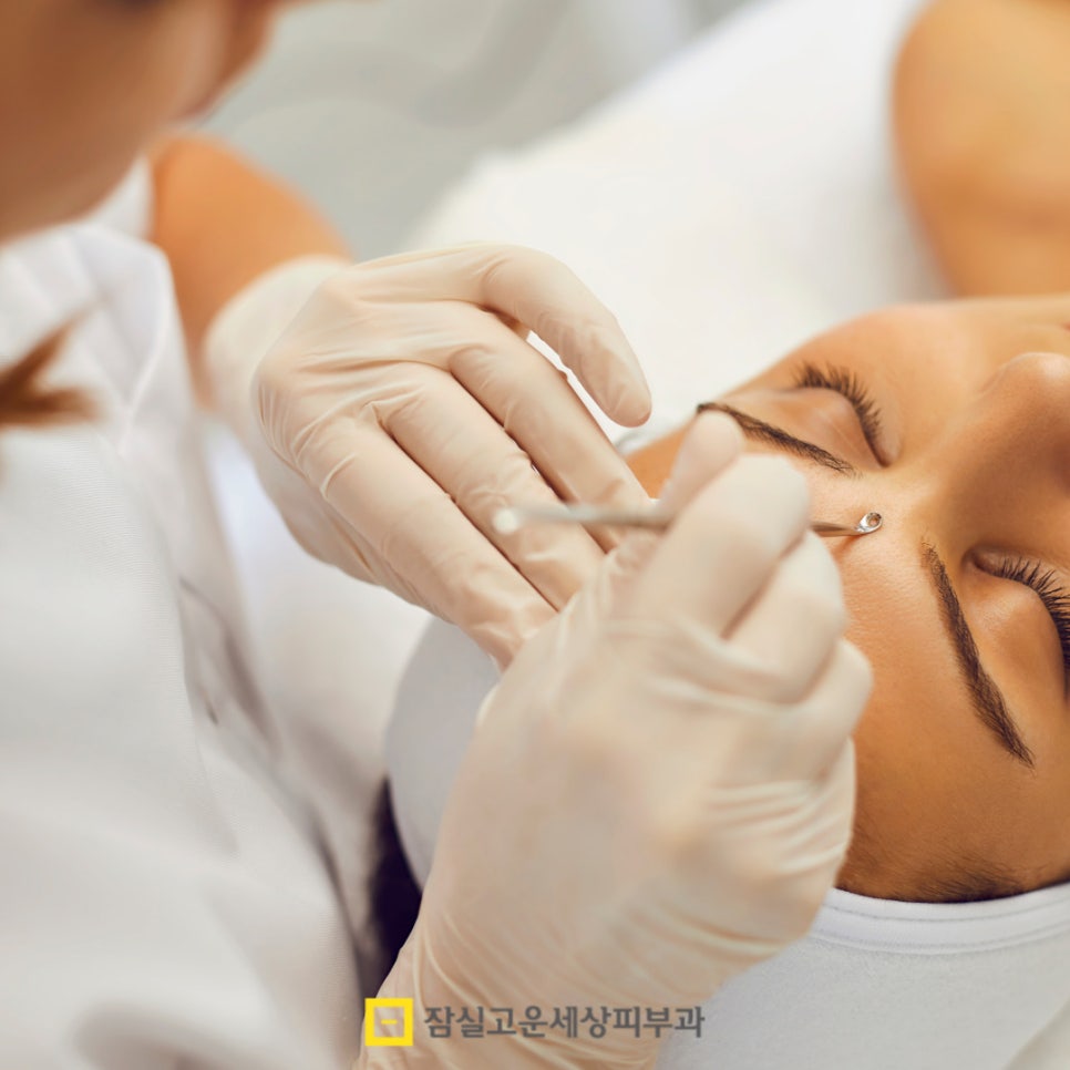 여드름 압출, 왜 해야 하고 어떻게 해야 안전할까? 관련 이미지 7
