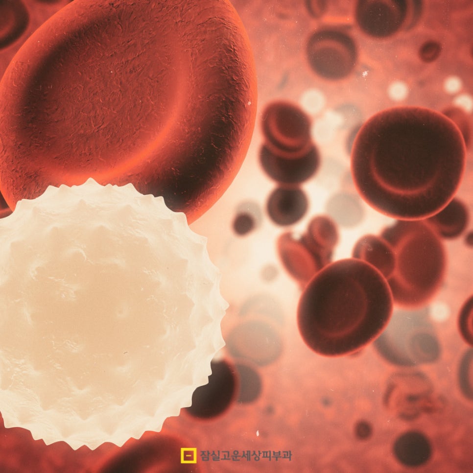 반복되는 하얀 각질과 붉은 반점, 건선일 수 있어요 관련 이미지 3