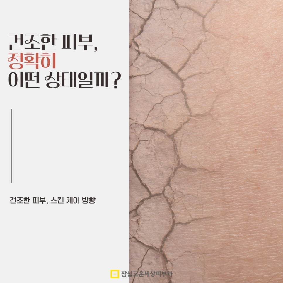 피부가 건조하다는 건 정확히 어떤 상태를 말하나요? 관련 이미지 1