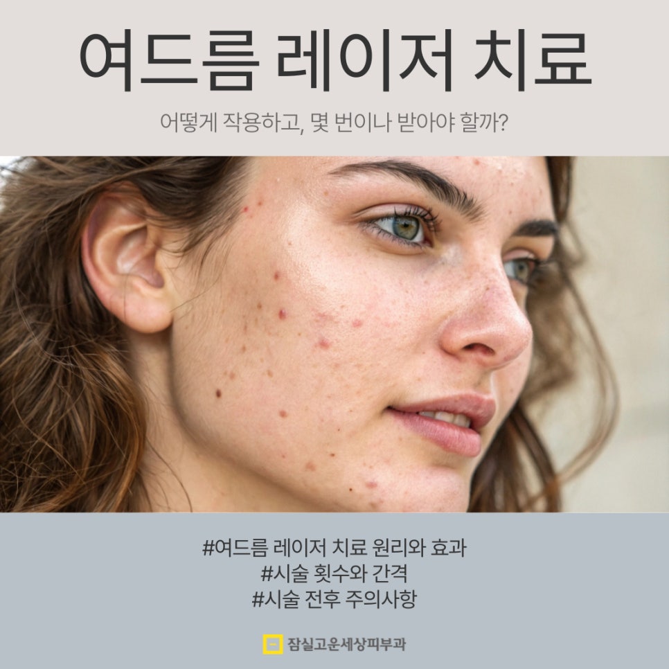 여드름 레이저 치료, 어떻게 작용하고 몇 번 받아야 할까? 관련 이미지 1