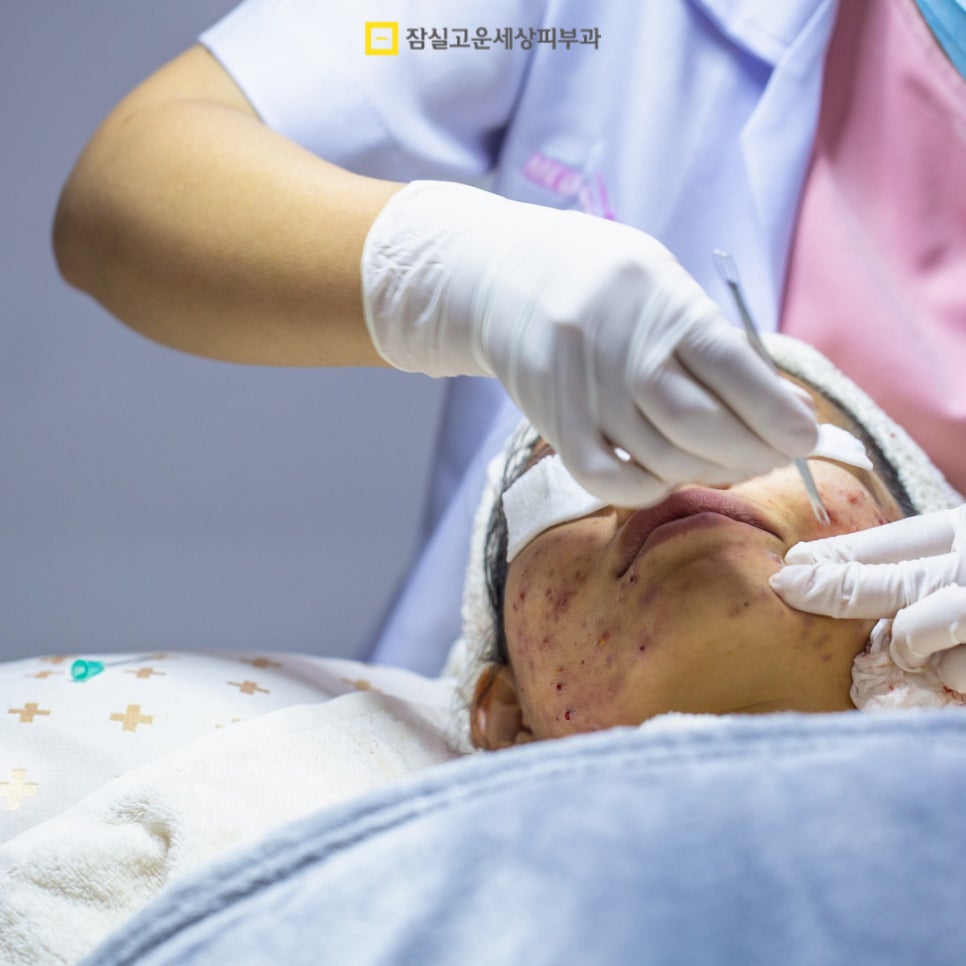 여드름 Q&A, 주요 궁금증들 관련 이미지 10