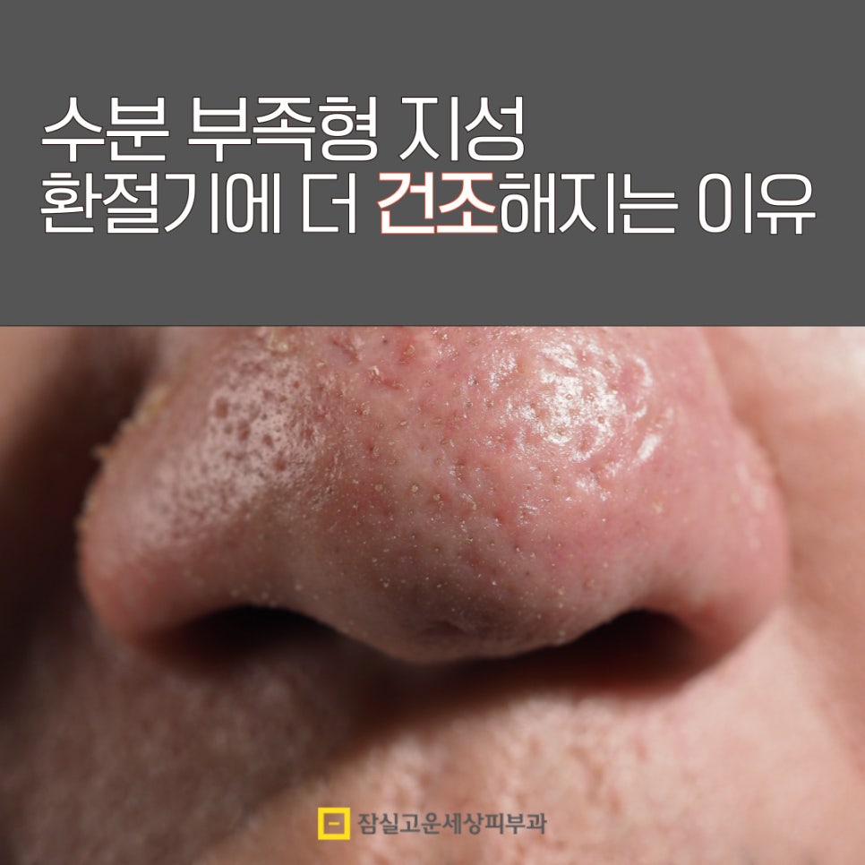 수분부족형 지성, 환절기에 더 건조해지는 이유 관련 이미지 1