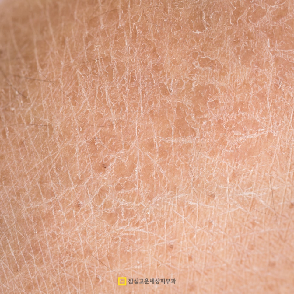 피부 노화 방지를 위한 5가지 핵심 관리법 관련 이미지 3