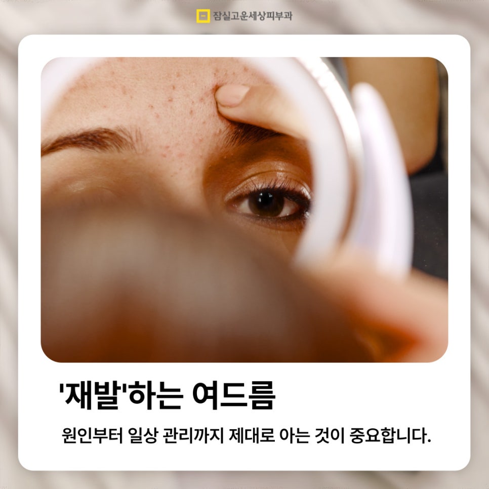 재발하는 여드름, 원인부터 일상 관리까지 제대로 아는 것이 중요합니다. 관련 이미지 1