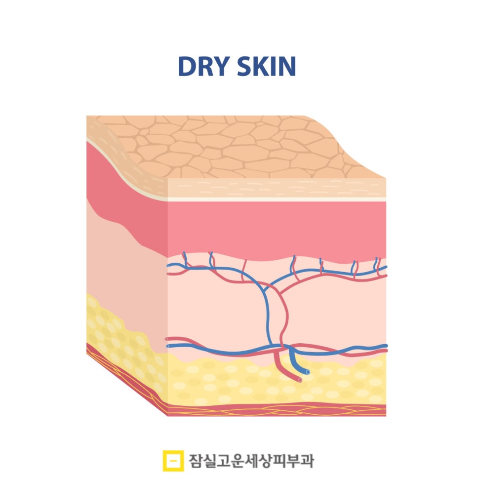 세안 후 당김이 심하다면, 단순 건조가 아닐 수도 있습니다 관련 이미지 5