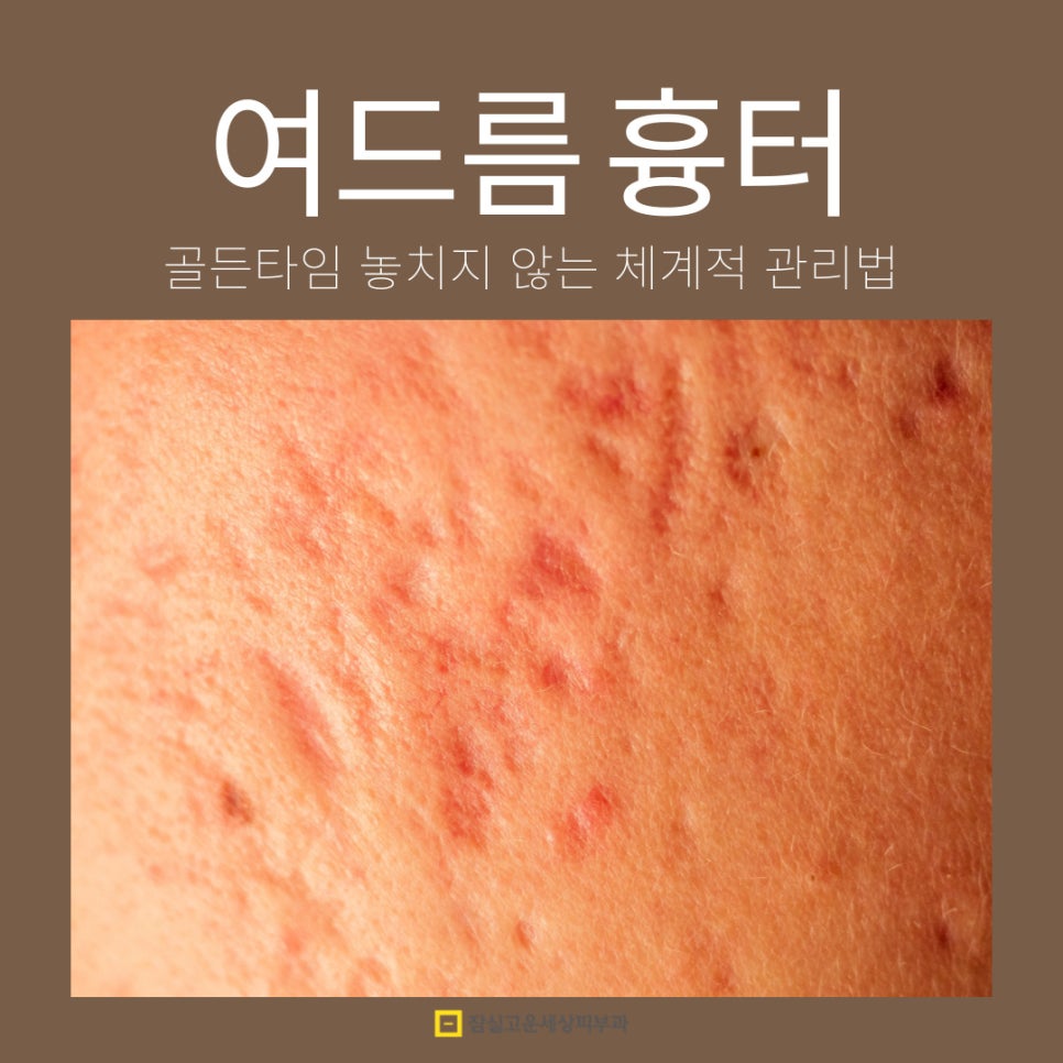 [잠실고운세상피부과] 여드름흉터, 골든타임 놓치지 않는 체계적 관리법 관련 이미지 1